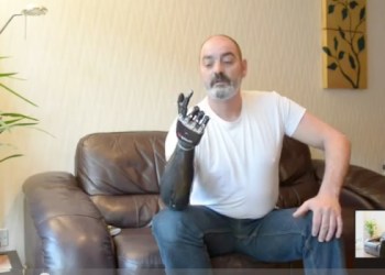 World's most advanced prosthetic limb